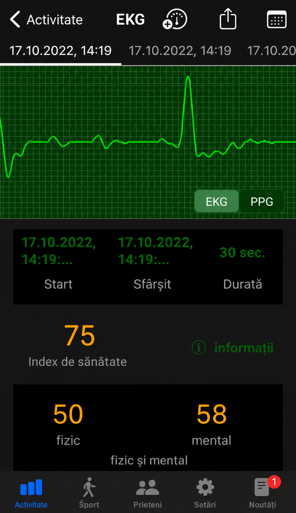 ekg ro